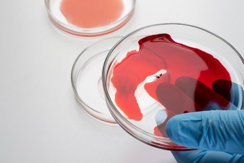 Bloodborne Pathogens (BBP)