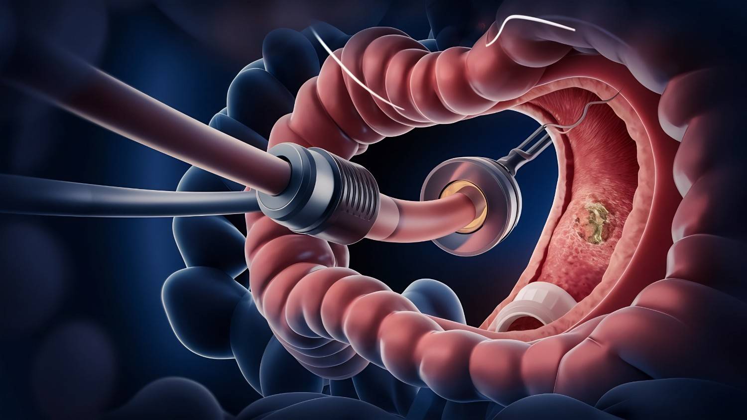 Upper gastrointestinal endoscopy