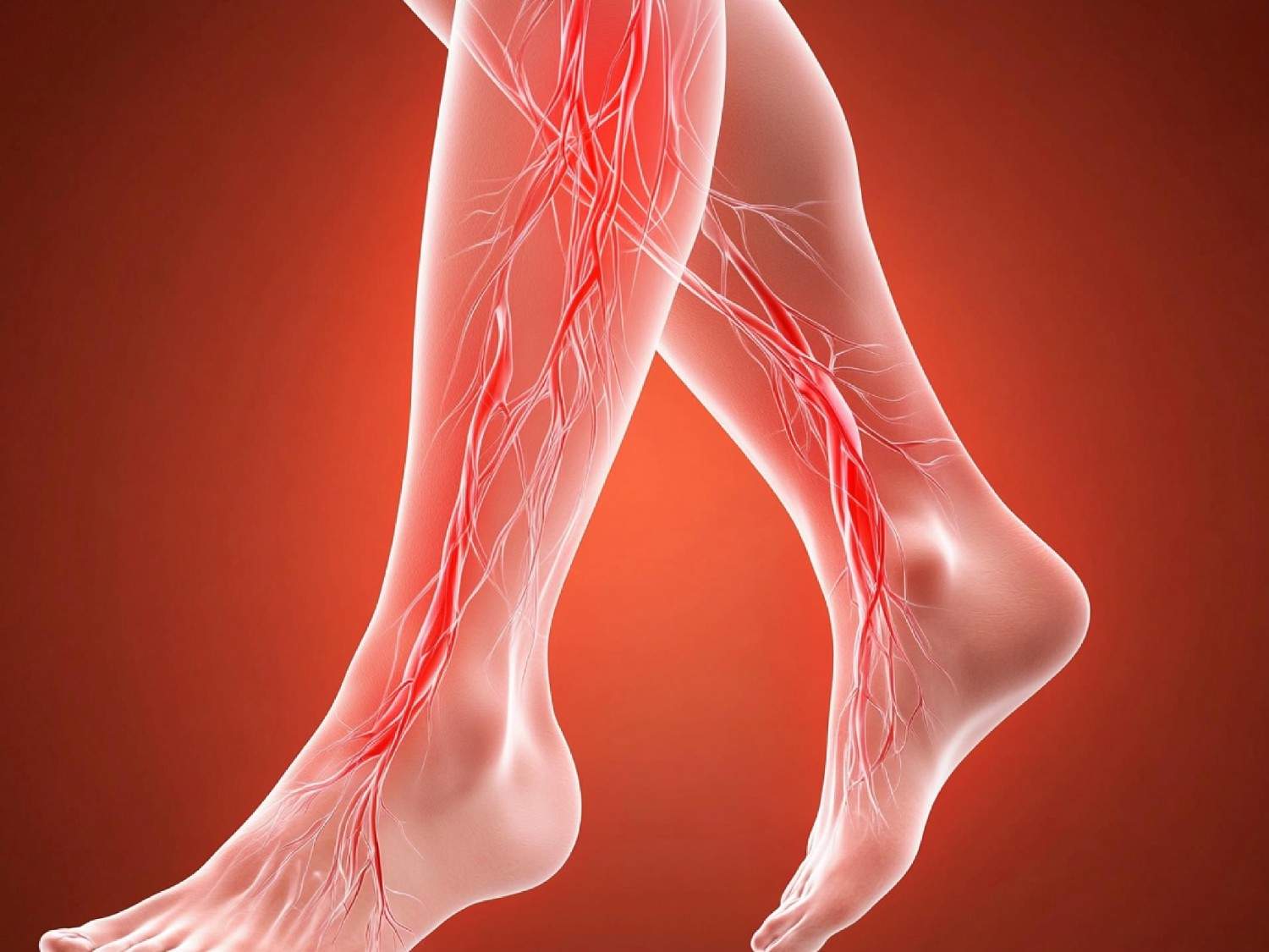 Deep vein thrombosis: update on diagnosis and management