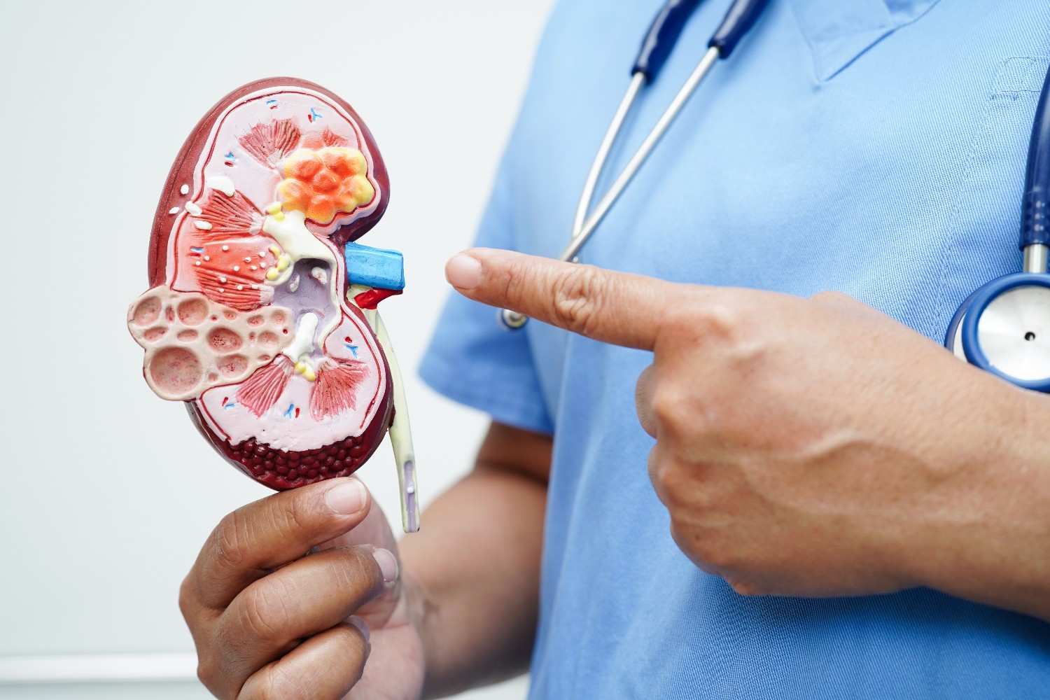 Chronic kidney disease in adults: diagnosis and management